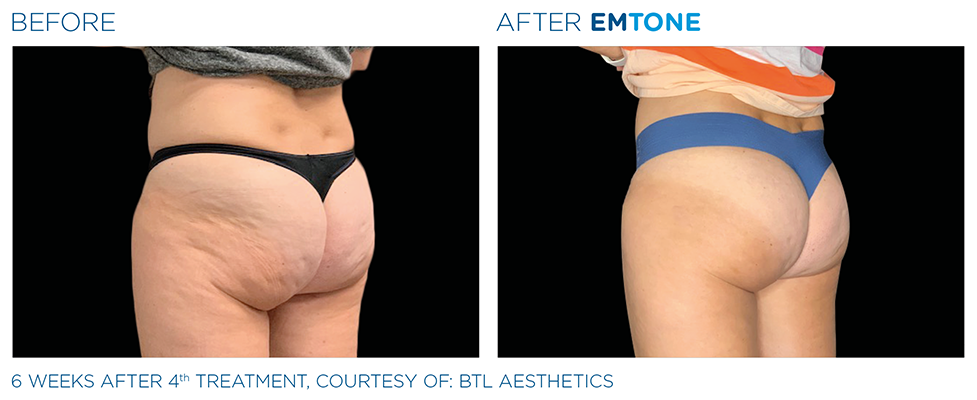 Emtone Services Lakeland Florida