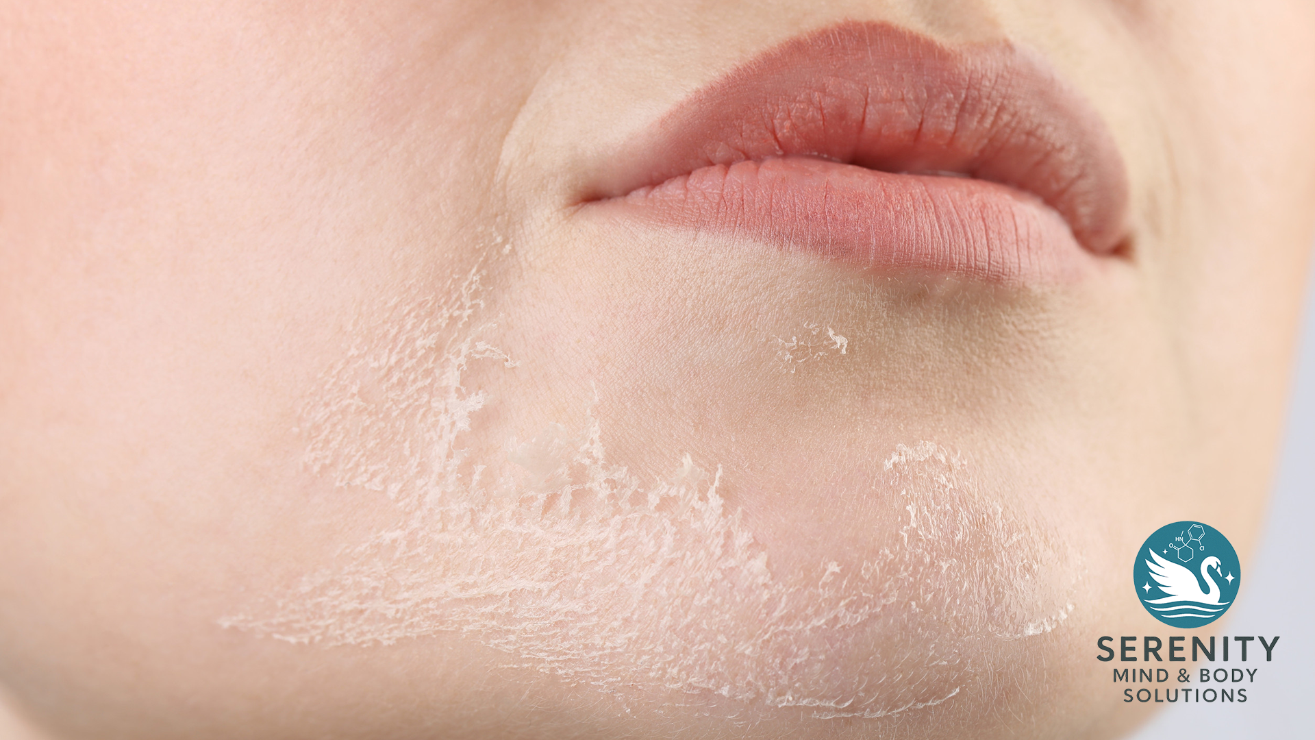 Sensitive skin and rosacea facial Lakeland Florida
